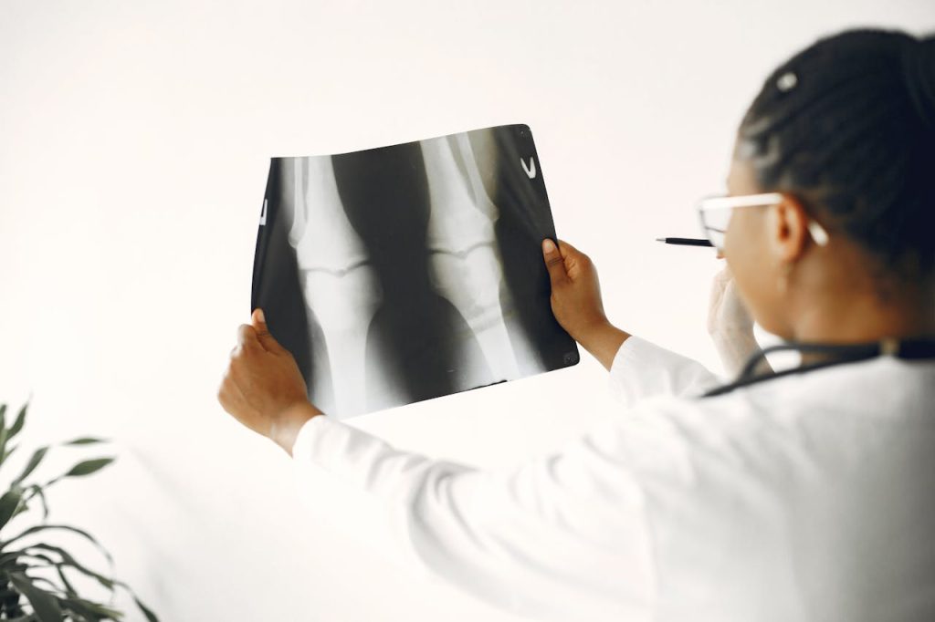 A doctor closely examining a patients knee X-ray for orthopedic evaluation.